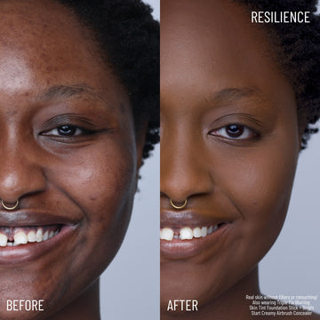 Resilience